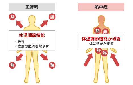 熱中症が起こる理由